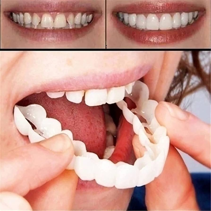 Carillas Snap On Smile