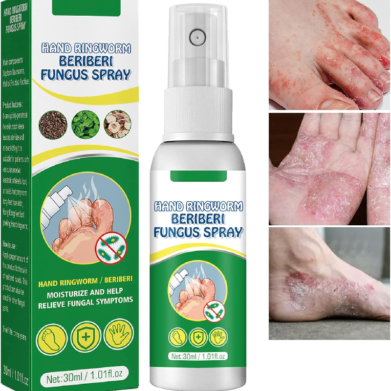 Medicina para el cuidado de manos y pies contra hongos