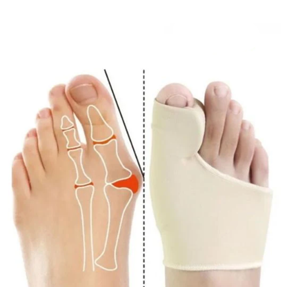 Corrector de Juanetes