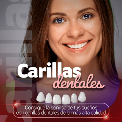 Carillas Snap On Smile