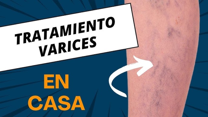 KIT ELIMINADOR DE VARICES, ESTRIAS Y QUEMA GRASA (copia)